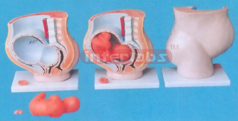 37 X 34 X 15CM GIANT SINGLE SIDE DELUXE PREGNANCY PELVIS, WITH 3-PART, (A TYPE)